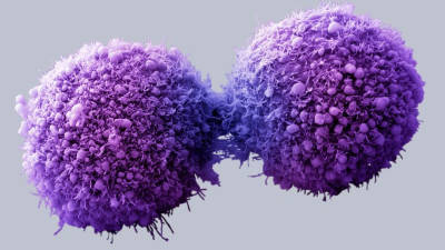 Cèl·lules de pàncrees canceroses completant la divisió cel·lular. Foto: ACN