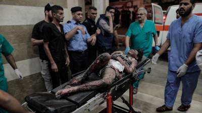 Palestinos heridos en un ataque israelí. Foto: EFE