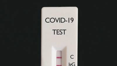 Rapid test for covid-19 antibodies (IgG/IgM) used as a preventive measure to stop the spread of the disease