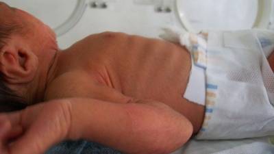 Bebé recién nacido en una unidad médica de neonatos