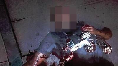 Un yihadista abatido en Cambrils. Todos ello llevaban un cinturón de explosivos simulado. FOTO: DT