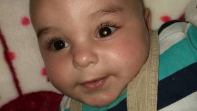 Este bebé, miembro de la fundación, tiene un brillo blanco en el centro del ojo izquierdo, un síntoma de la enfermedad. FOTO: CEDIDA