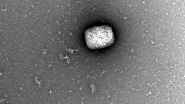 Partículas de la viruela del mono vistas en un microscópio. Foto: EFE