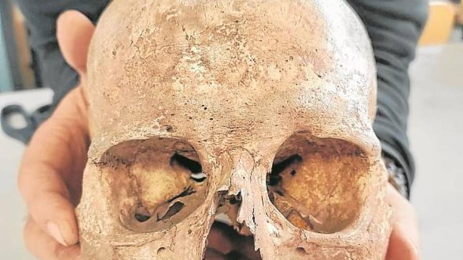 Crani trepanat cedit pel Museu de la Vida Rural. FOTO: A.Rodriguez-Hidalgo