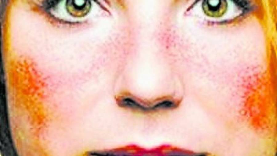 Las marcas en la piel de la cara son síntoma frecuentes del lupus.