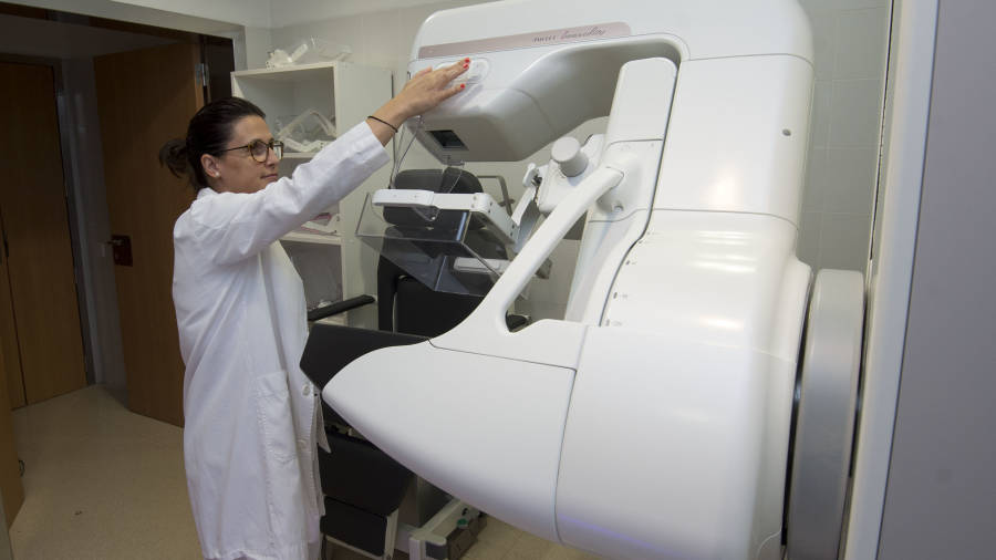 Imatge del nou mamògraf de què disposa l’Hospital Verge de la Cinta. FOTO: JOAN REVILLAS
