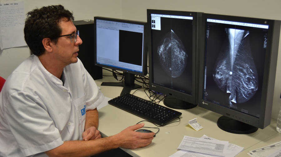 Una mamografia realitzada amb el nou mamògraf digital que permet obtenir múltiples imatges. FOTO: M. PLANA
