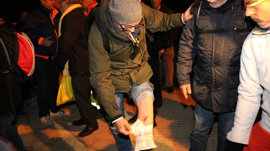 Un ciudadano con una herida en la rodilla en una actuaci&oacute;n policial para desalojar gente del medio de la calzada en Mas d'Enric. ACN