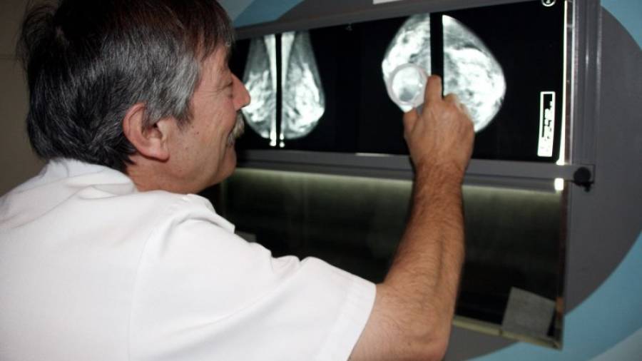 En la imagen, una mamografía. ACN