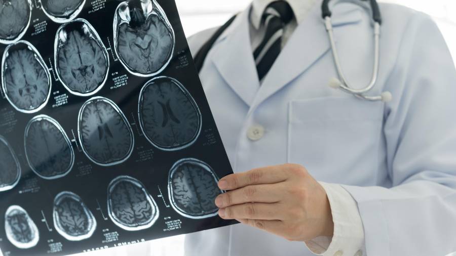 Los tumores cerebrales causan una mortalidad del 85% de los casos en un plazo de dos años desde el diagnóstico. FOTO: GETTY IMAGES