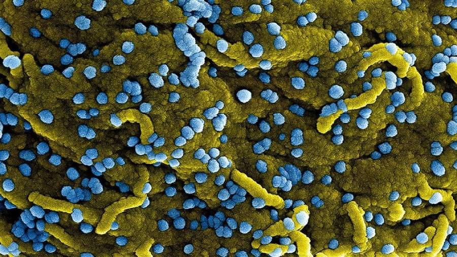 Micrografía electrónica de barrido coloreada de partículas de un virus. FOTO: FLICKR