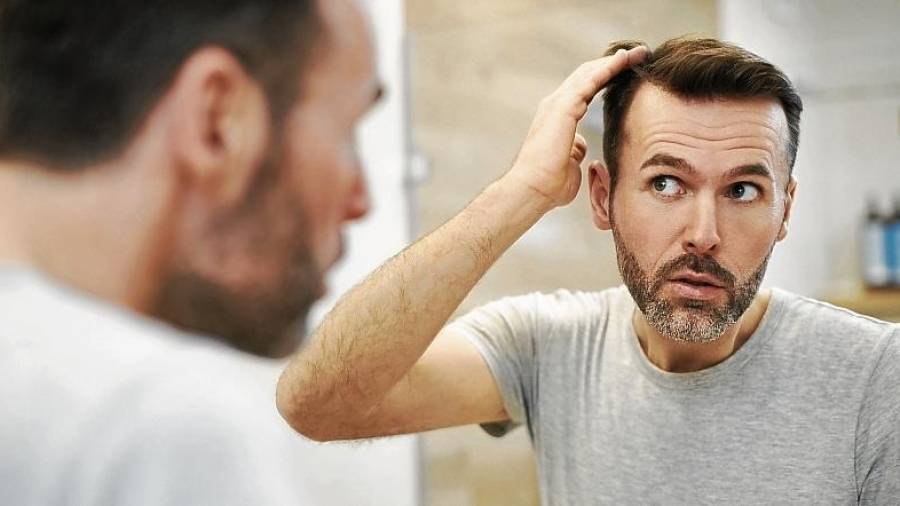 El descubrimiento puede revolucionar la industria relacionada con el problema de la alopecia o pérdida del cabello. FOTO: Getty Images