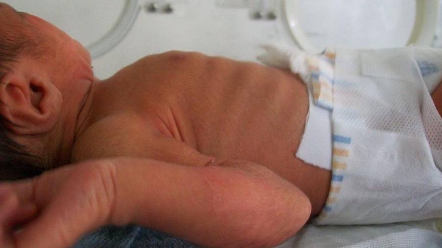 Bebé recién nacido en una unidad médica de neonatos