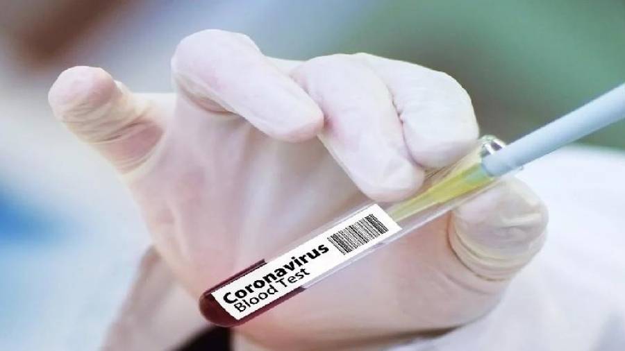 El Gobierno ruso prevé registrar el próximo 15 de octubre su segunda vacuna, que ha finalizado hoy la fase II de los ensayos clínicos. Foto: EFE