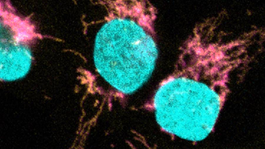 La microscopia confocal muestra la co-localización de EXD2 (magenta) con el ribosoma mitocondrial (amarillo). El ADN se tiñe para definir el núcleo (cian). Foto: URV