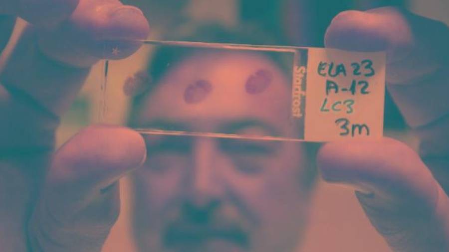 Un científico que estudia la ELA en una imagen de archivo. EFE